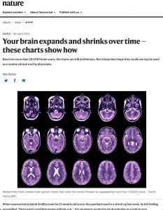 Your Brain Expands and Shrinks Over Time &ndash; These Charts Show How